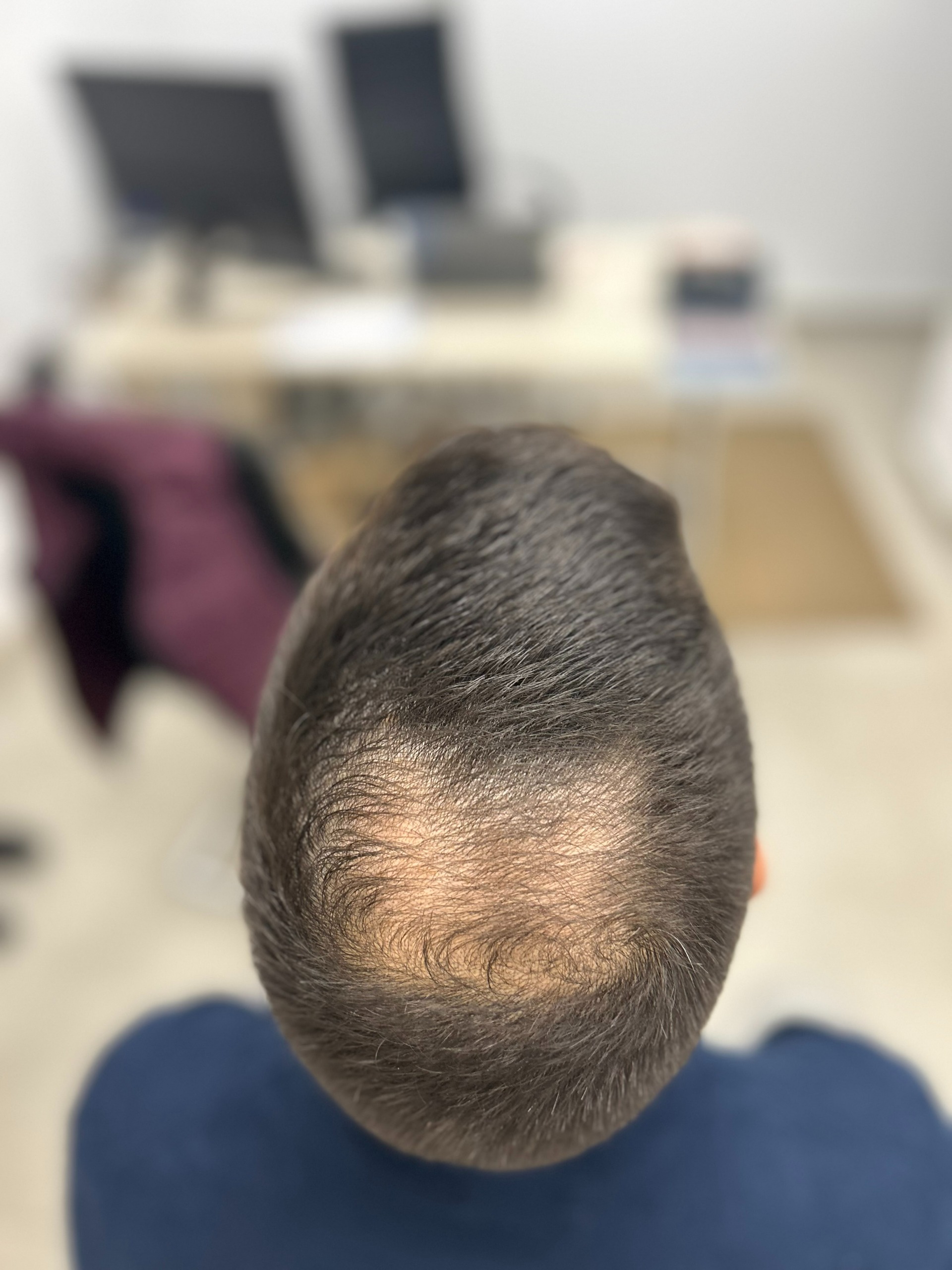 Antes del tratamiento · Caso 5